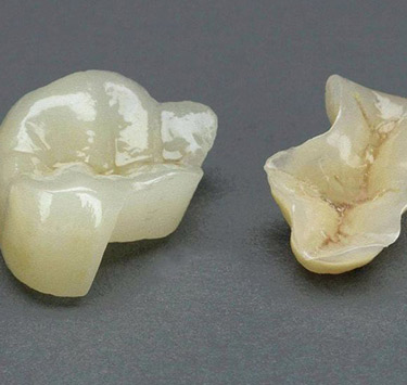 缺損修復(fù)